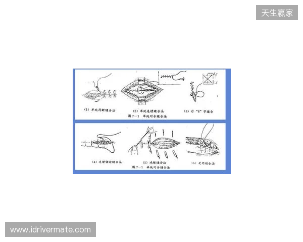 广州豹官方:杨浩眉弓伤口缝合30余针,预计5-7天后拆线 广州豹官方:杨浩眉弓伤口缝合30余针,预计5-7天后拆线
